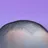 秃顶