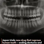 teeth regrows (REGROWS) konvertor va kalkulyatori