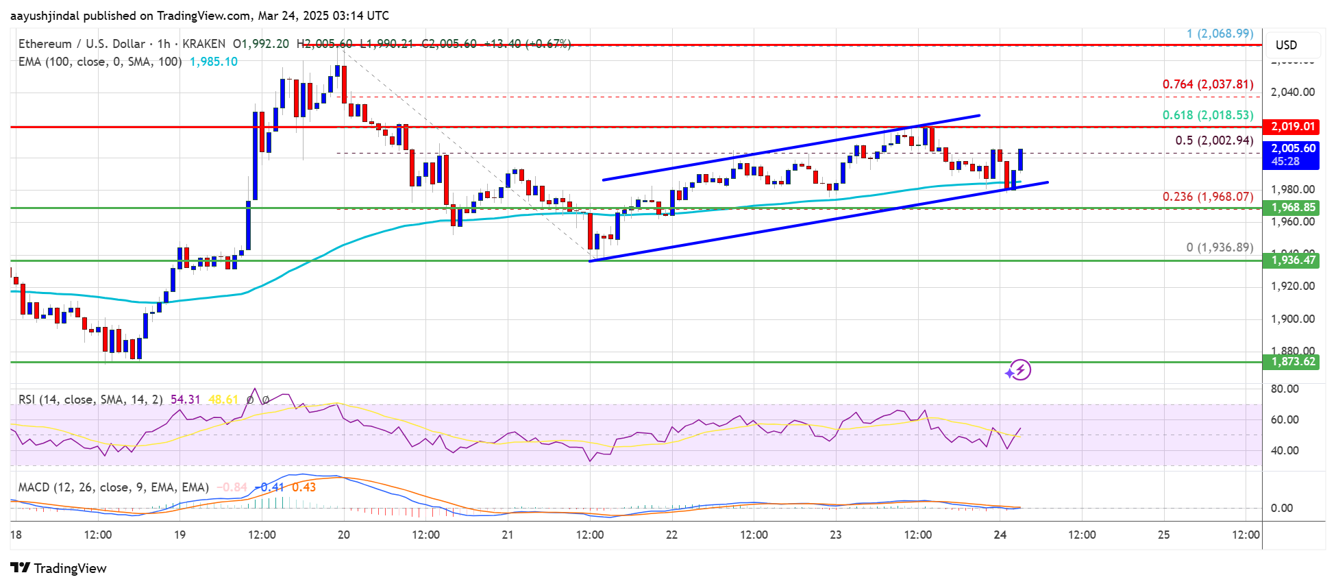 Ethereum Price Teases a Breakout—Can This Spark a Momentum Shift