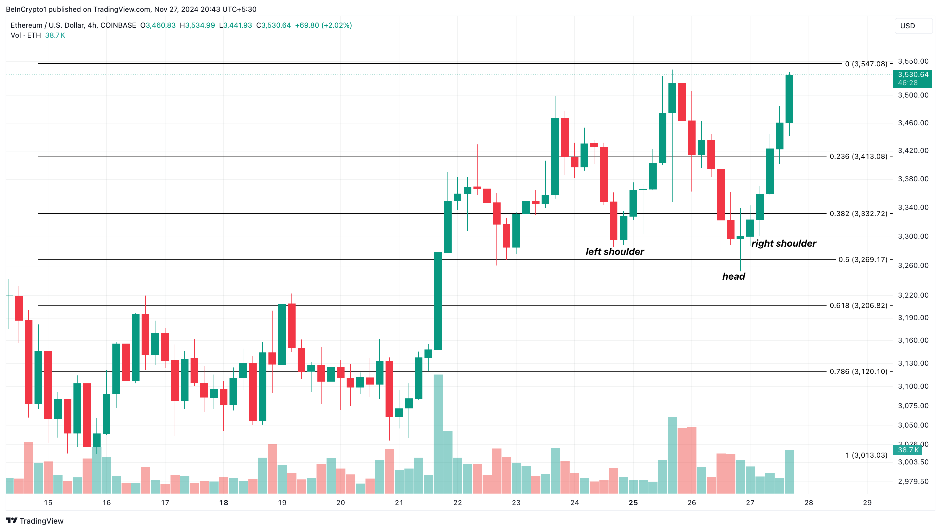 Ethereum (ETH) Price Regains Footing After $3,000 Scare — What Lies Ahead image 2