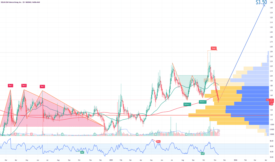 SLS SELLAS Life Sciences Group Options Ahead of Earnings image