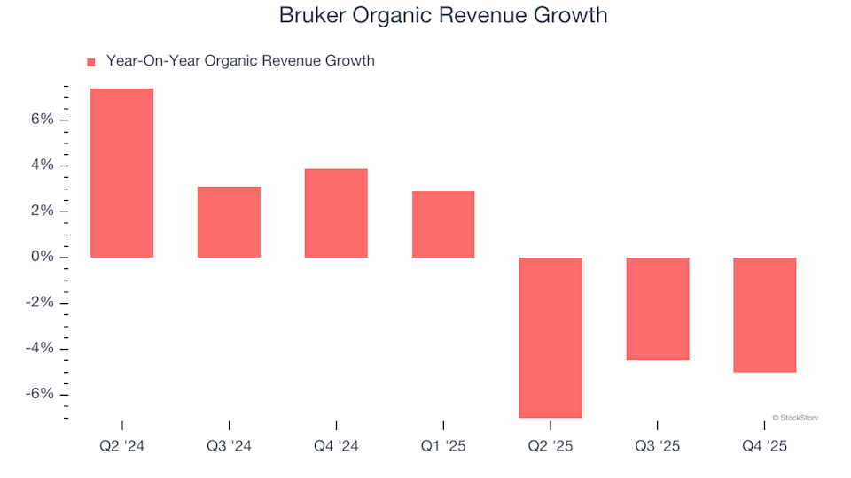 Bruker (BRKR): Should You Purchase, Sell, or Retain After Q4 Results? image