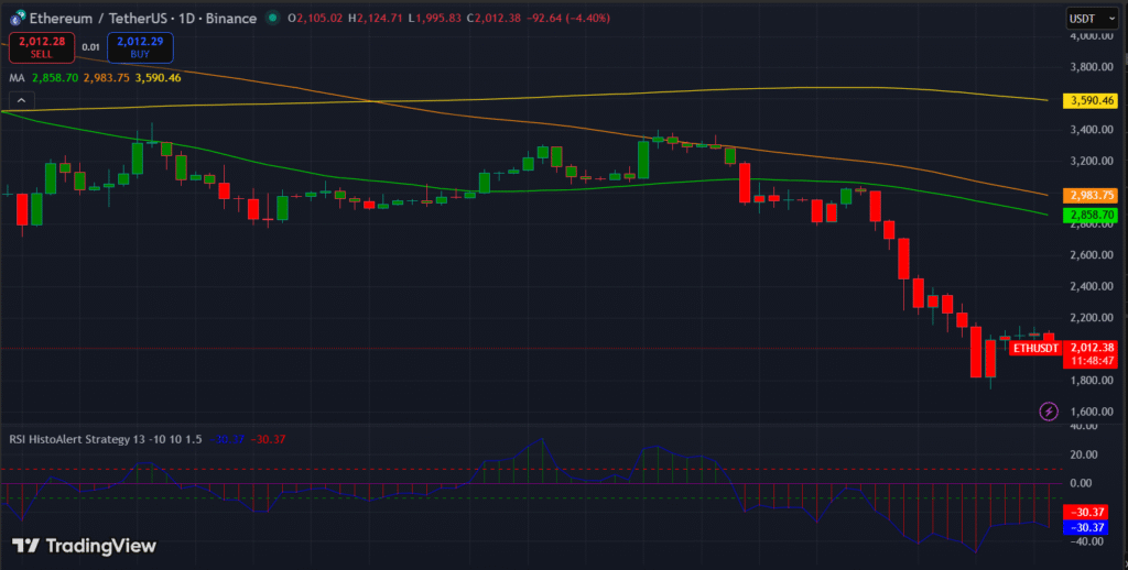 Ethereum Remains Under Pressure as Price Consolidates Near $2,000
post-157084
post-157084
post-157084